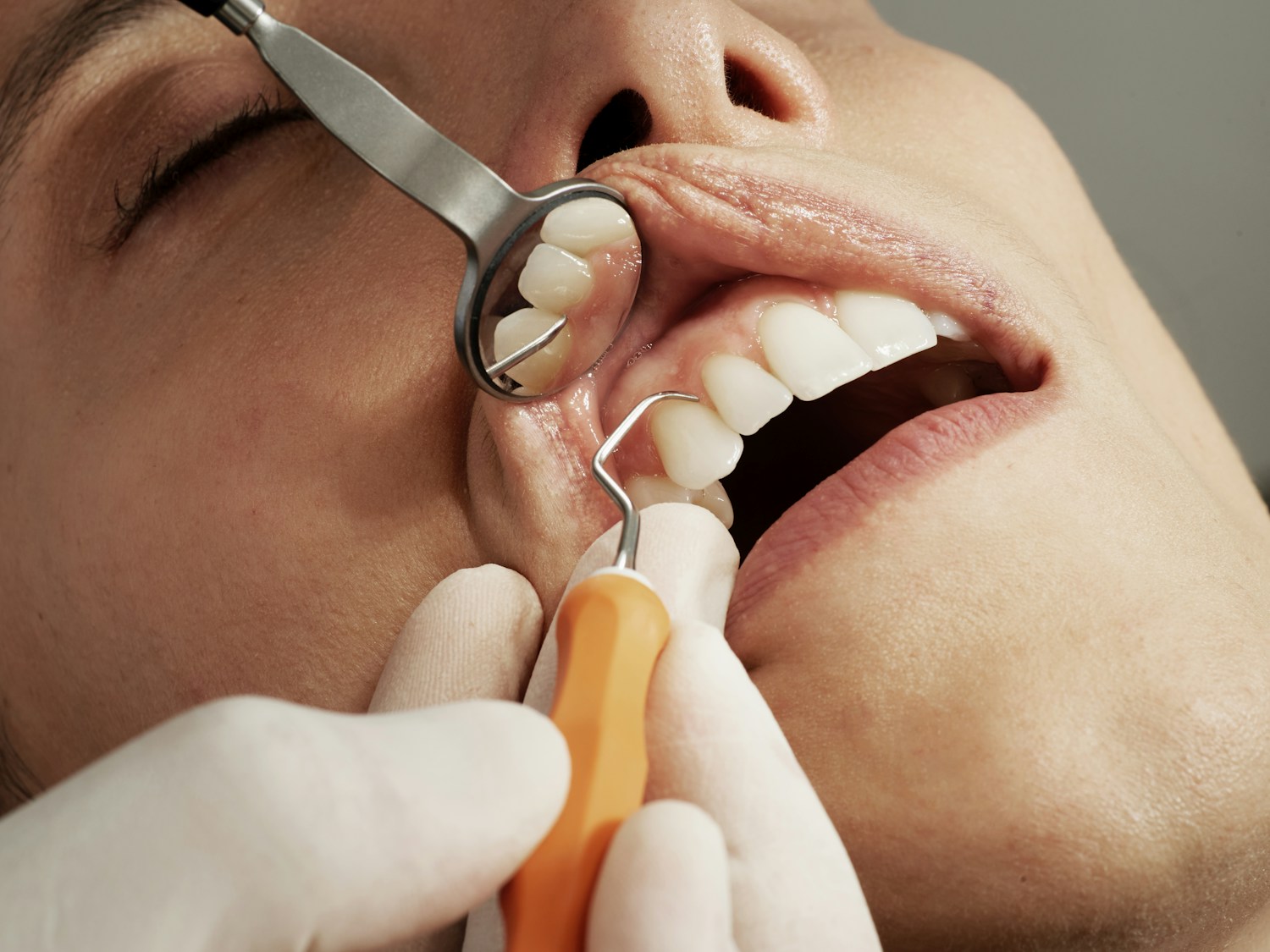 Routine dental care